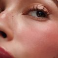 Freckle-Hero-2_Mobile